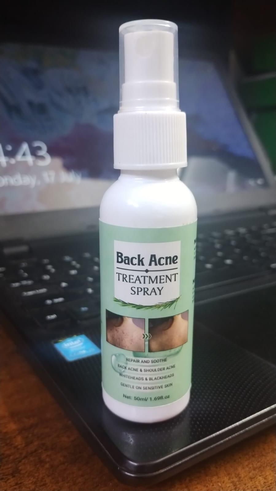 Buy The New Back Acne Treatment Spray (Pack of 2) - BestCart