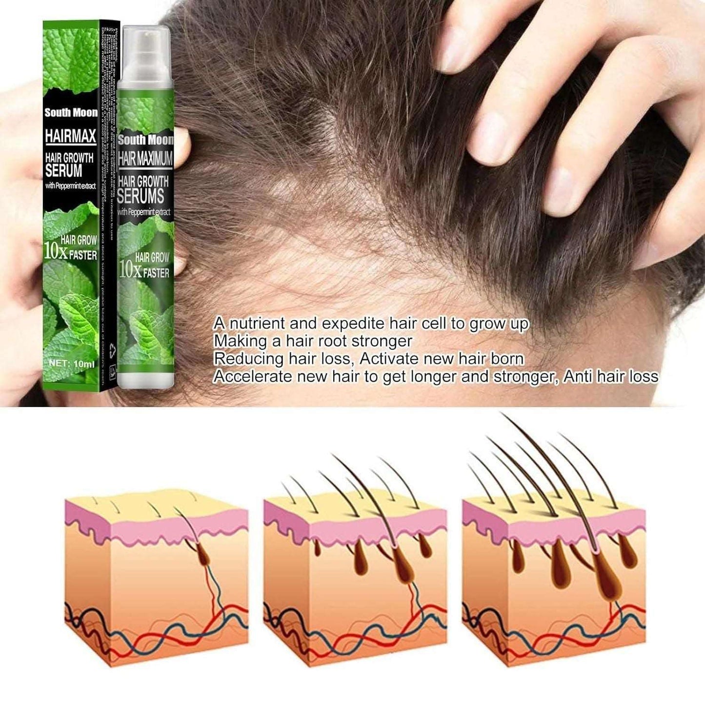 Buy The New Ginger Plant Extract Anti-Hair Loss Hair Serum (Pack Of 3) - BestCart