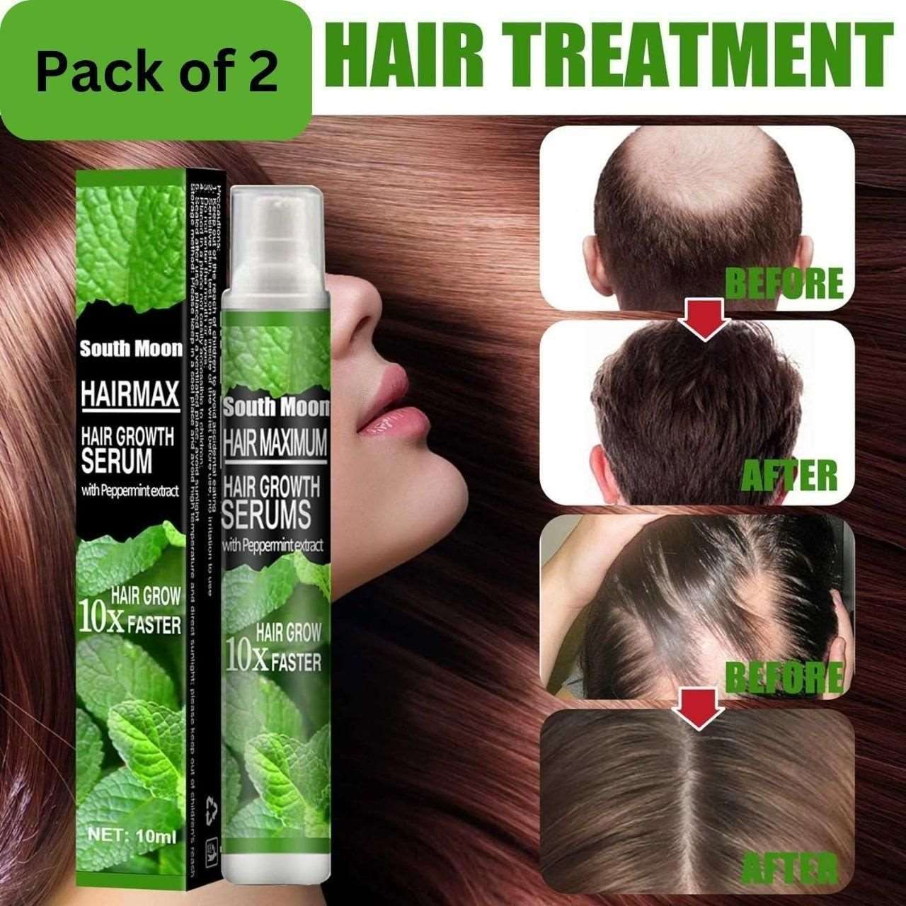 Buy The New Ginger Plant Extract Anti-Hair Loss Hair Serum (Pack of 2) - BestCart