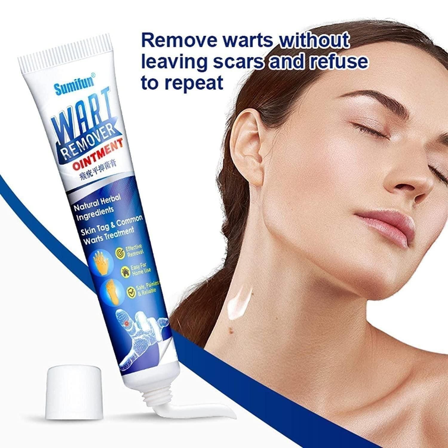 Buy The New WartsOff Instant Blemish Removal Cream Warts Off Instant Blemish Removal Cream 20 g Wart Remover Ointment for All Skin Types (Pack of 2) - BestCart