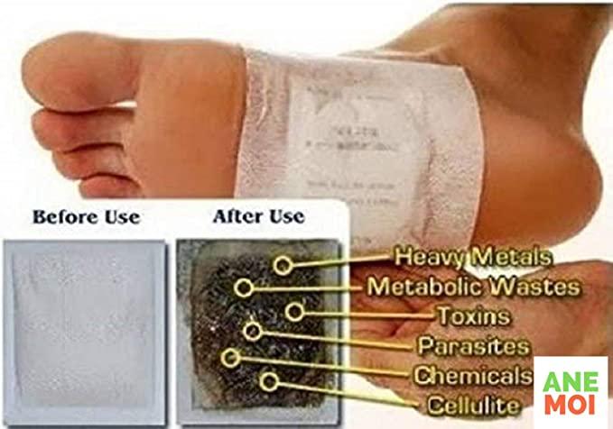 Buy The New Detox Foot Patches (Set of 10) - BestCart