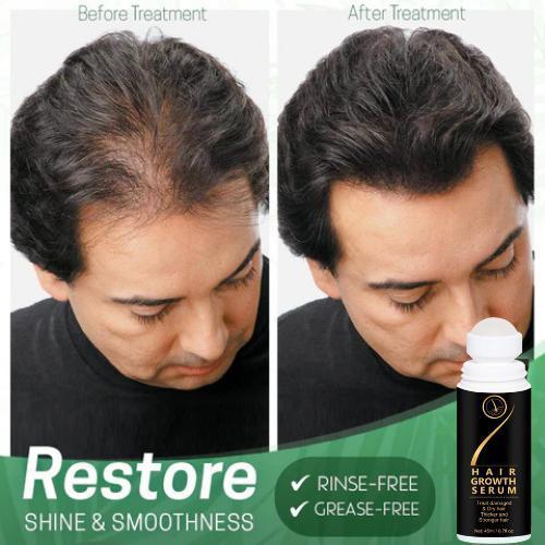 Buy The New Regrowth Organic Hair Serum Roller 45ml - BestCart