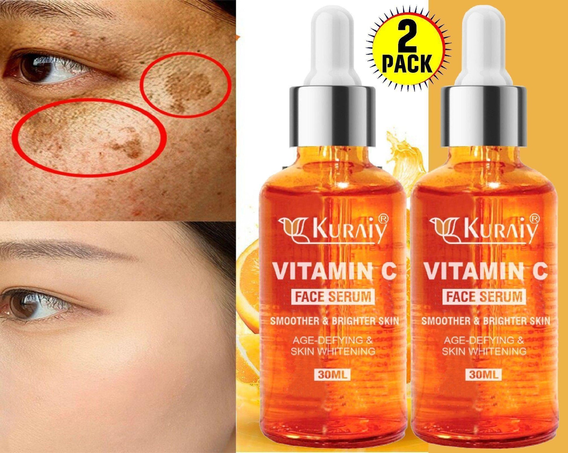 Buy The New KURAIY 100% Organic Vitamin C Face Serum - BestCart