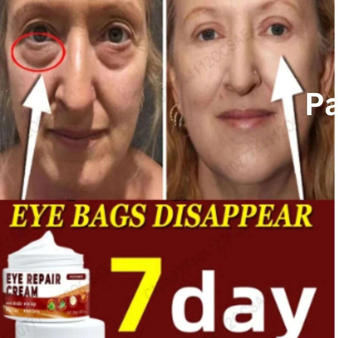 Buy The New Eye Repair Cream (Pack of 2) - BestCart