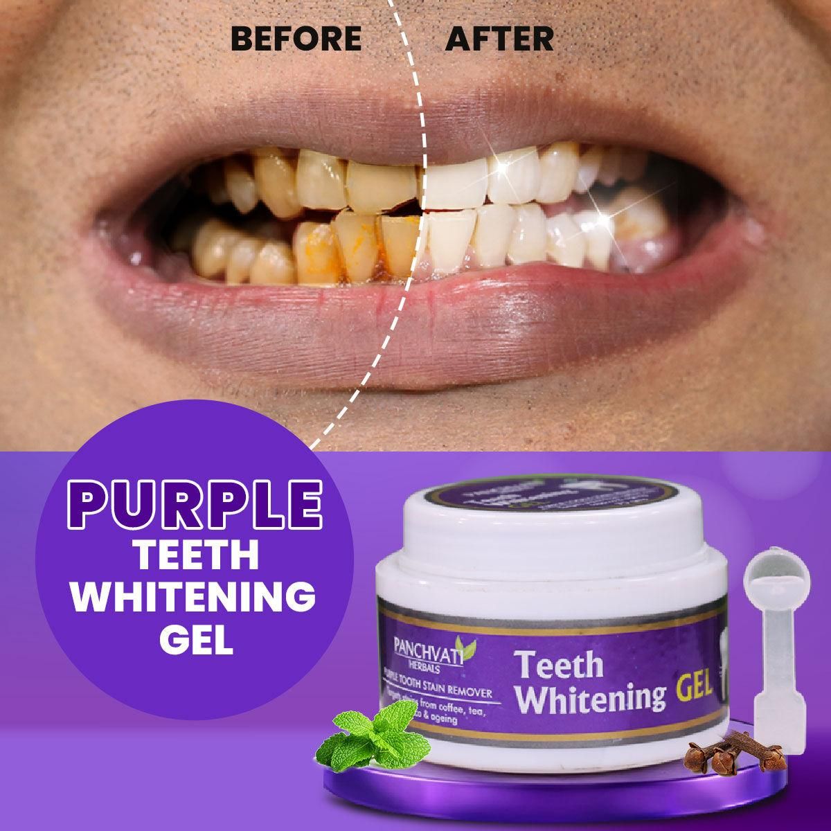 Buy The New Purple Teeth Whitening Gel - BestCart