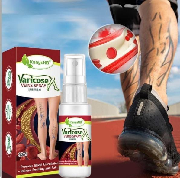 Buy The New Vein Healing Varicose Veins Treatment Spray - BestCart