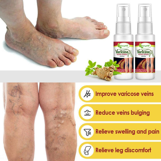 Buy The New Varicose Veins Treatment Spray - BestCart